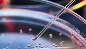 新研究为骨缺陷疾病治疗找到重要干细胞来源 新研究为骨缺陷疾病治疗找到重要干细胞来源