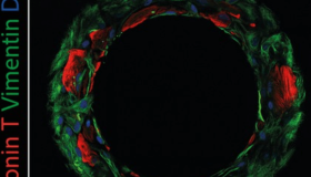 eLife:iPSC来源的心肌细胞构建环形心肌组织模型 eLife:iPSC来源的心肌细胞构建环形心肌组织模型