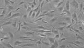 艾米迈托赛注射液(人脐带间充质干细胞药物)上市首例患者出院 艾米迈托赛注射液(人脐带间充质干细胞药物)上市首例患者出院