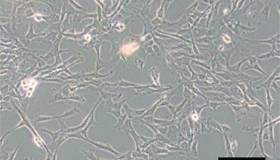 全骨髓贴壁筛选法分离培养大鼠骨髓间充质干细胞 全骨髓贴壁筛选法分离培养大鼠骨髓间充质干细胞