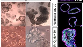CellStemCell: 低氧环境(HIF – KLF 通路)调控促进人肺干细胞分化命运 CellStemCell: 低氧环境(HIF – KLF 通路)调控促进人肺干细胞分化命运