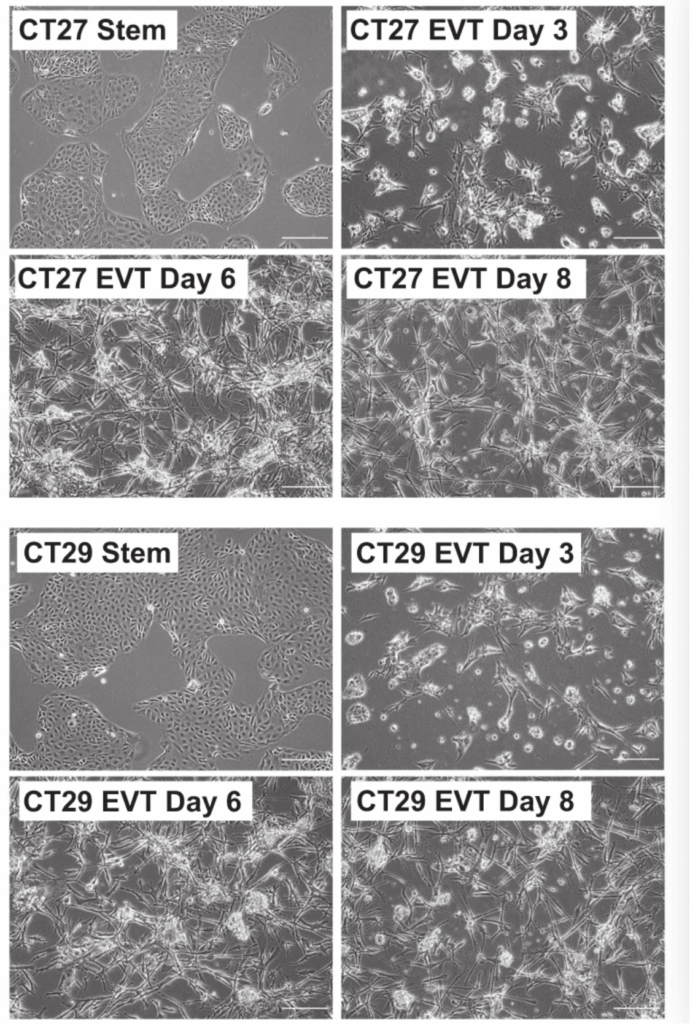 绒毛外滋养层细胞(Extravillous trophoblast cell)体外分化形态 绒毛外滋养层细胞(Extravillous trophoblast cell)体外分化形态