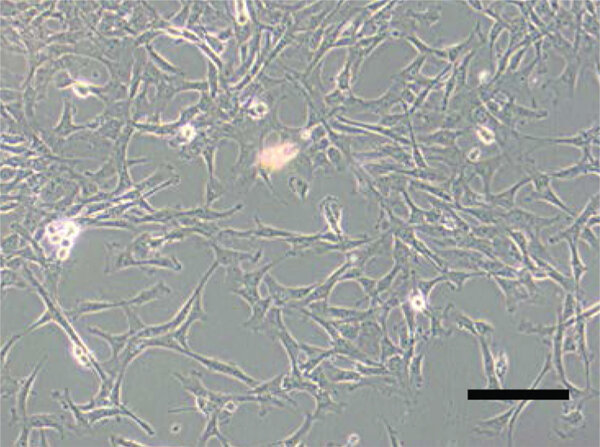 全骨髓贴壁筛选法分离培养大鼠骨髓间充质干细胞 全骨髓贴壁筛选法分离培养大鼠骨髓间充质干细胞
