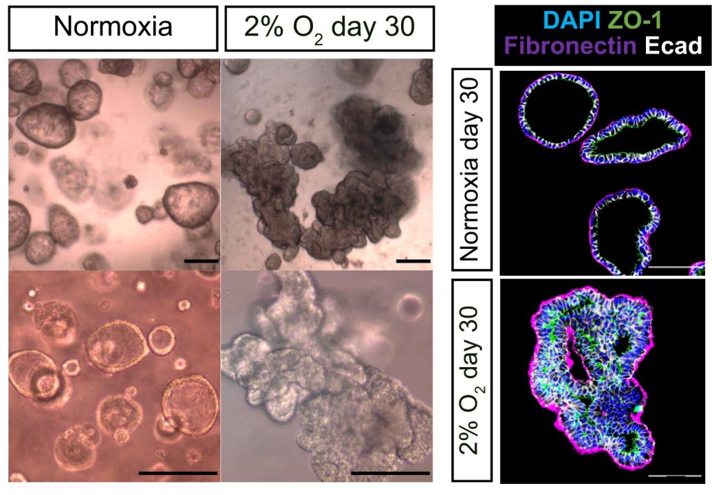 CellStemCell: 低氧环境(HIF - KLF 通路)调控促进人肺干细胞分化命运 CellStemCell: 低氧环境(HIF - KLF 通路)调控促进人肺干细胞分化命运